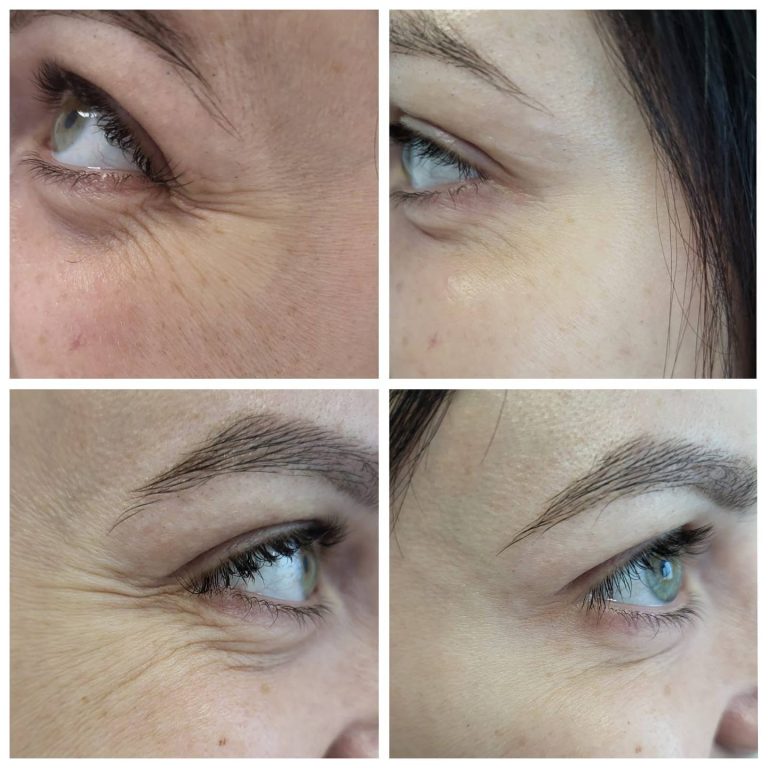 photo 2026 02 08 16 58 30 (2)